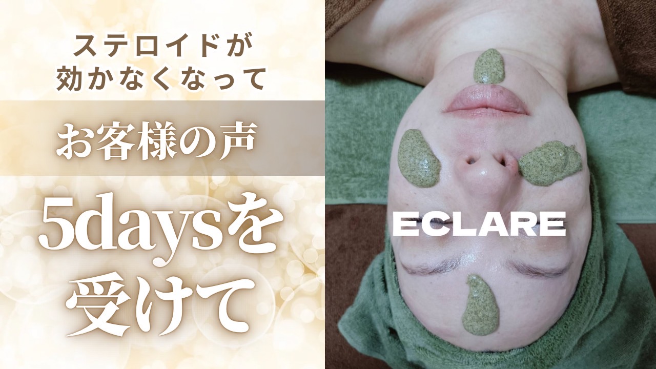 ステロイドが効かなくなって お客様の声 5daysを受けて